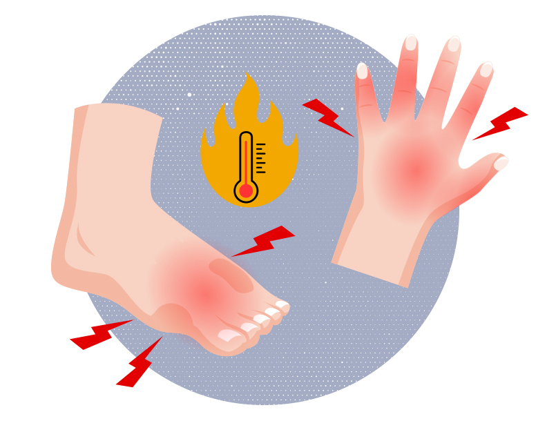 Illustration: A hand and foot with lightning bolts and a thermometer to suggest inflammation.