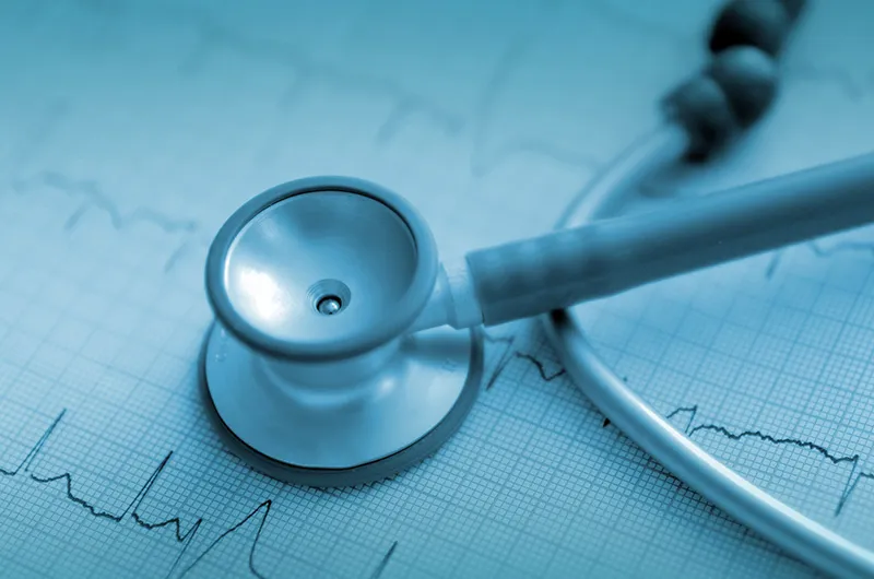 stock image of a stethoscope on top of EKG results