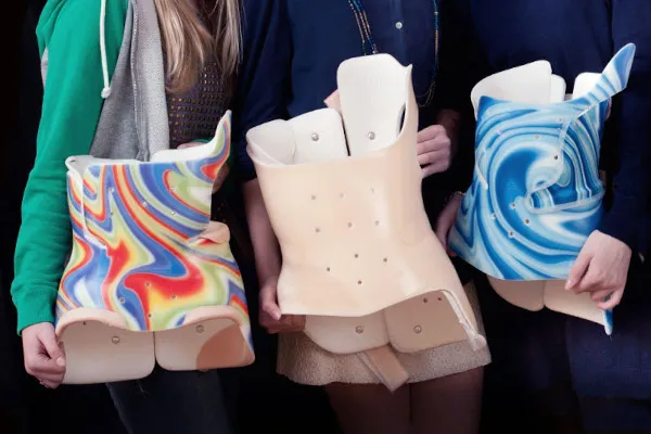 Adolescents with scoliosis show off their braces.